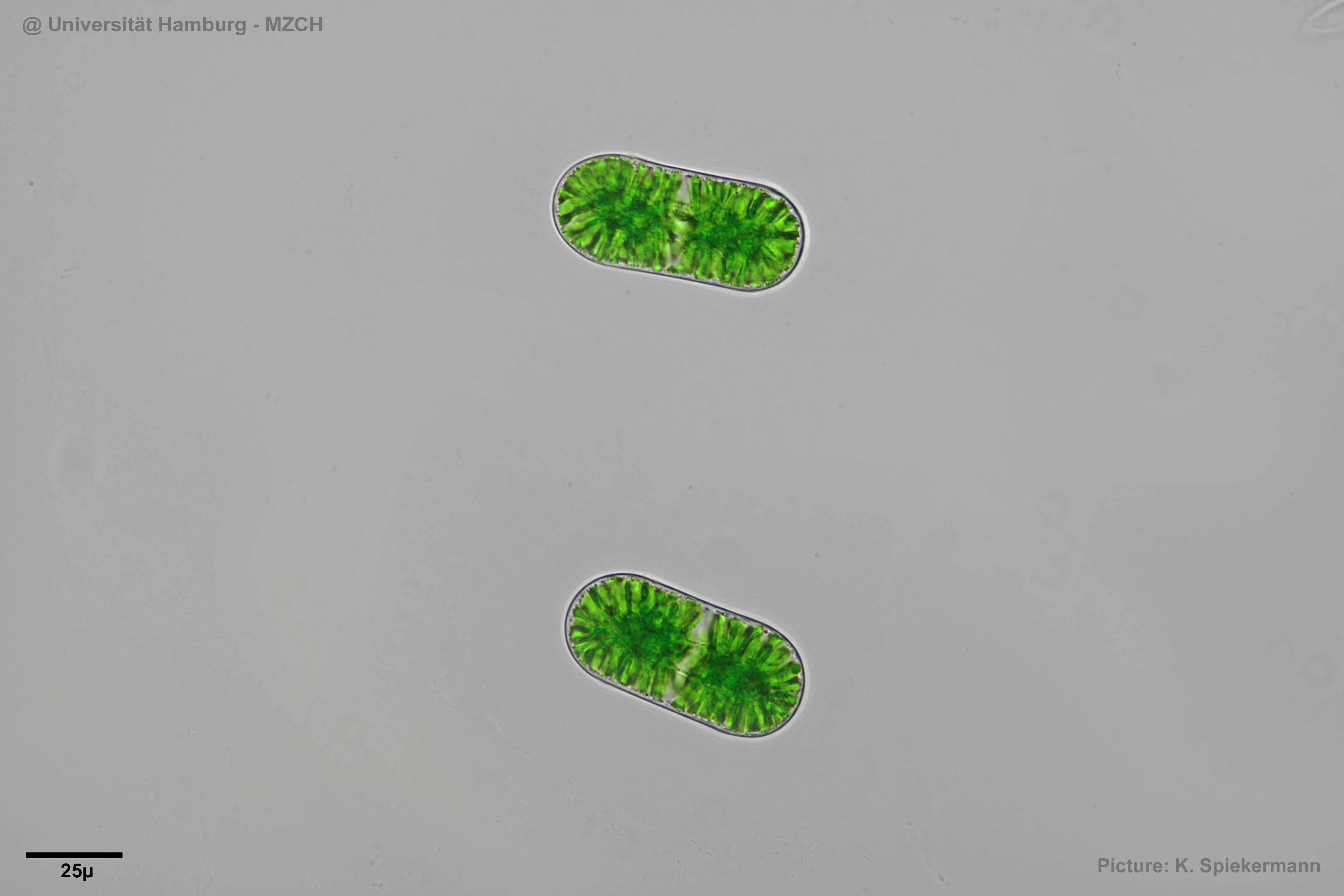 402_Cylindrocystis crassa